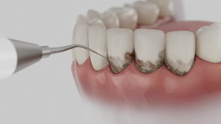 Reliable Dental contractor in Wisner, NE by Smile Center Dentistry